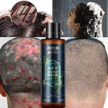 Vlasovú pokožku, vlasový Folikul Cleansing Shampoo Antibakteriálne Anti-svrbenie Roztočov Oil Control Psoriáza, Keratín, starostlivosť o Vlasy Starostlivosť o Pleť